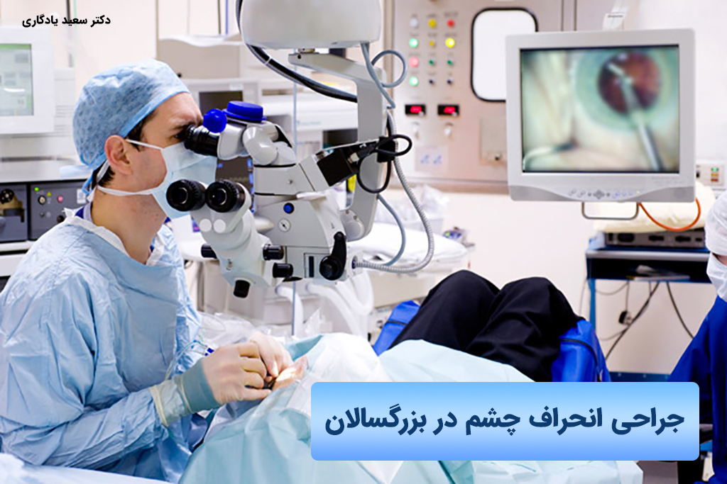 درمان انحراف چشم