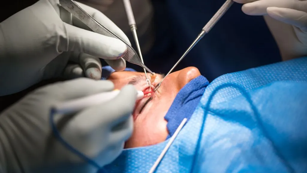 درمان افتادگی پلک