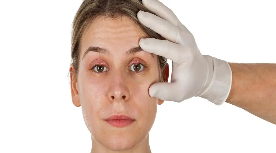 تشخیص عفونت چشم