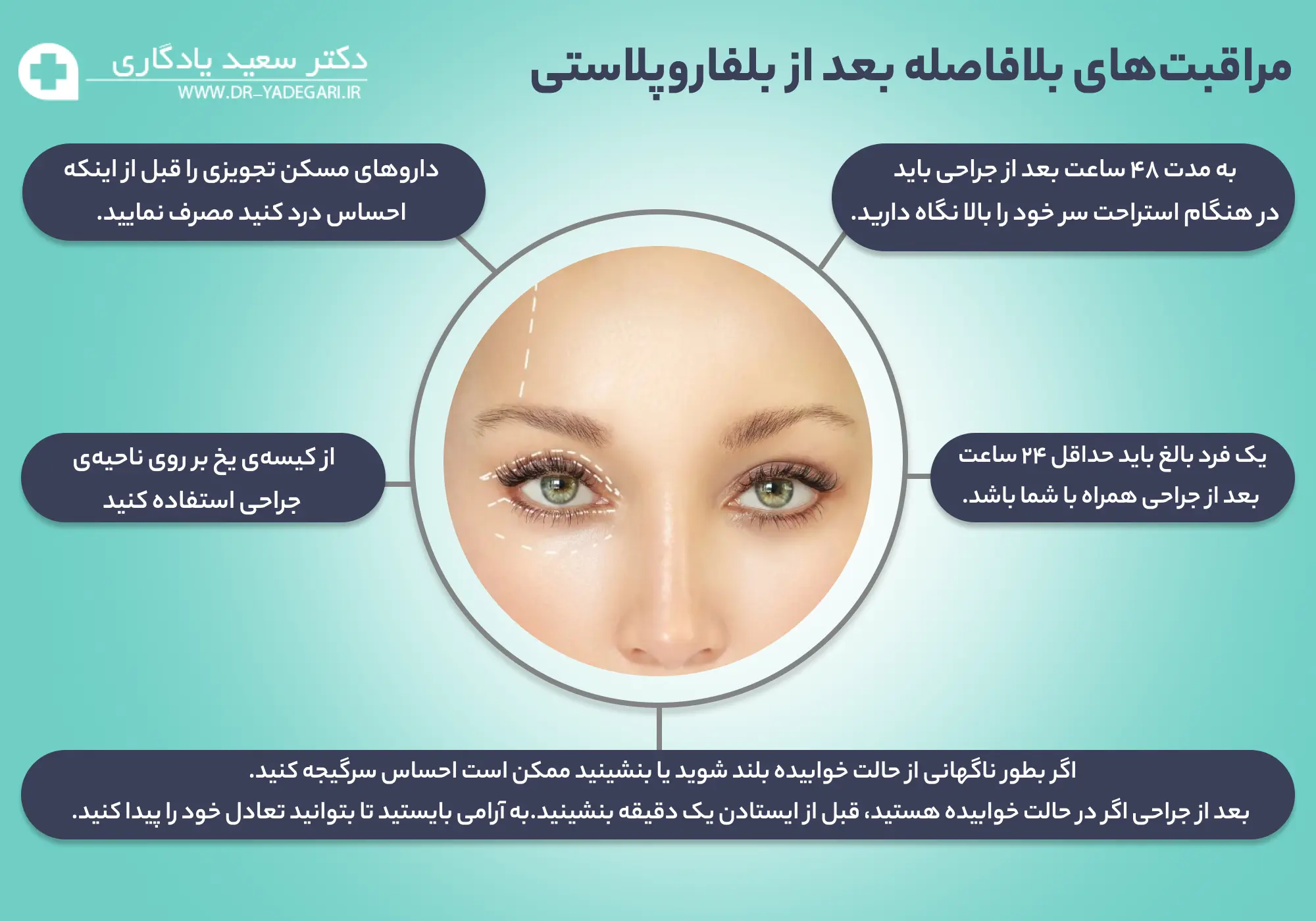 مراقبتهای بعد از بلفاروپلاستی