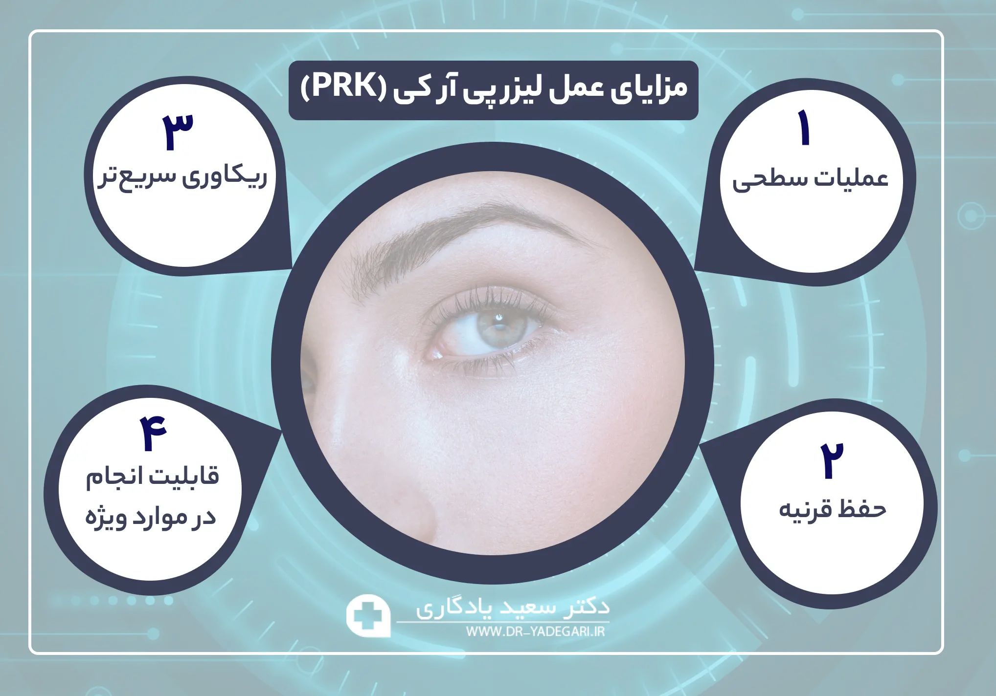 مزایای عمل پی ار کی