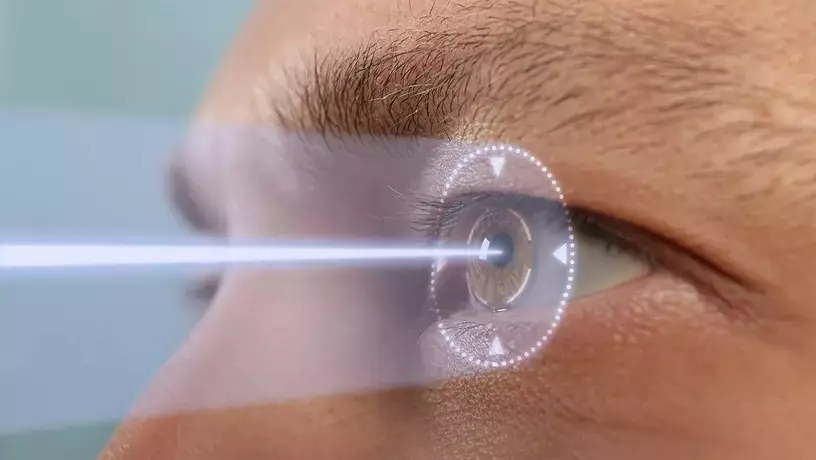 هزینه عمل لیزیک چشم دکتر سعید یادگاری