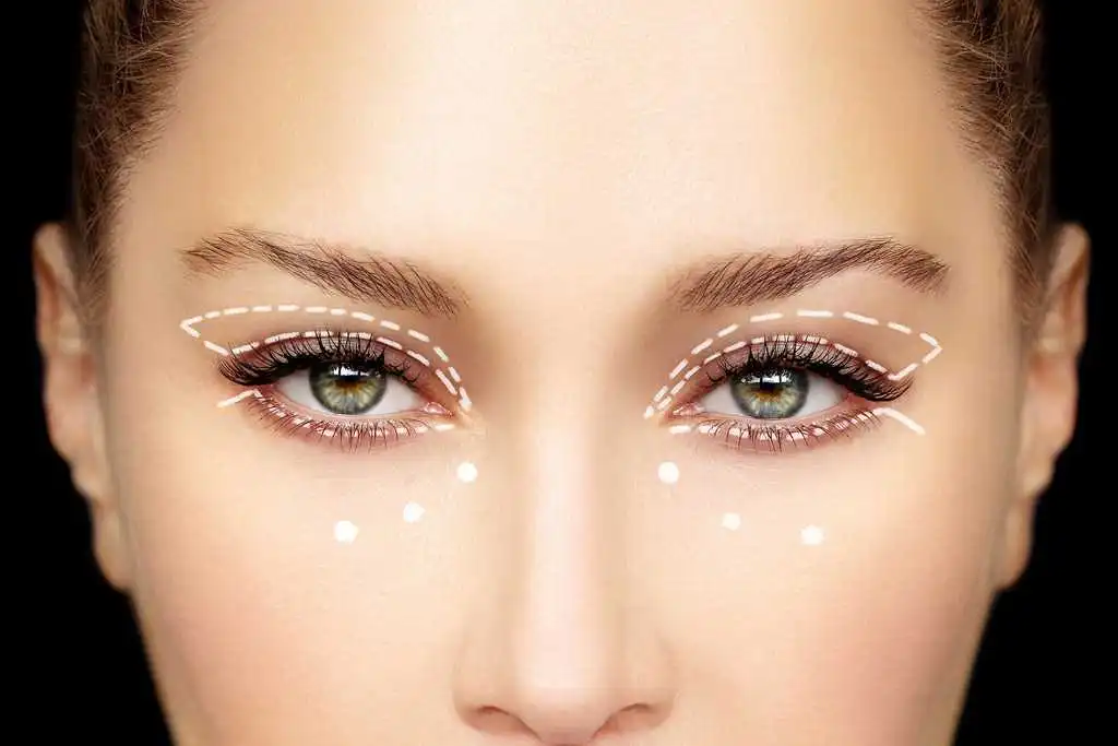 بهترین جراح زیبایی چشم در تهران