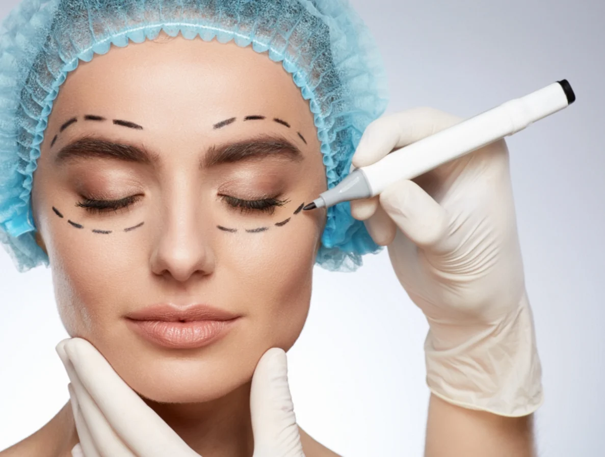 بهترین دکتر بلفاروپلاستی در تهران