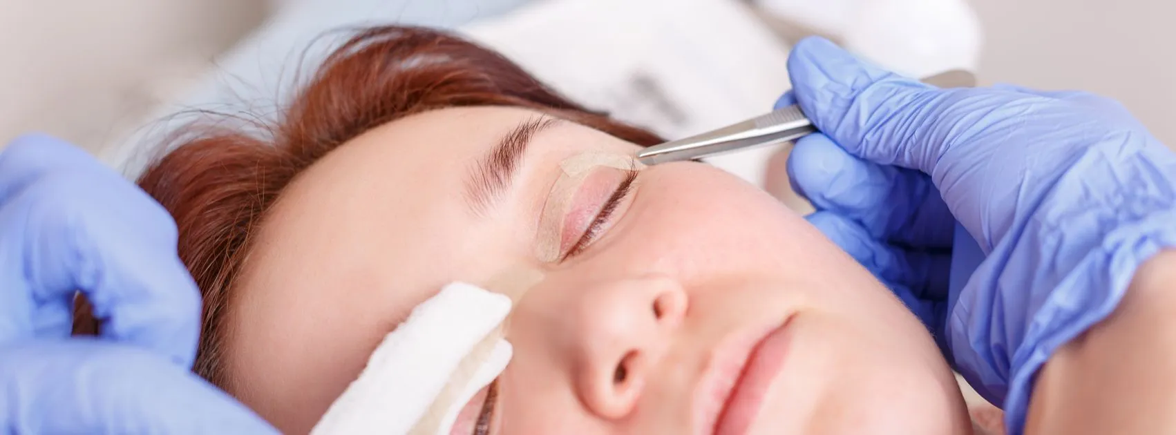 بهترین دکتر جراح پلک خانم در تهران